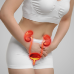 incontinence urinaire